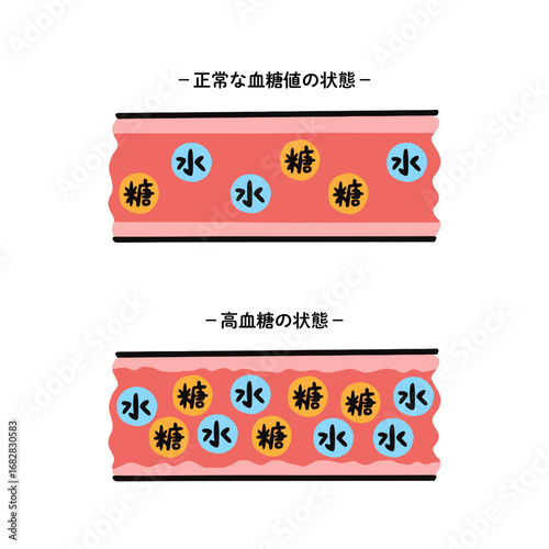 正常な血糖値の血管と高血糖状態の血管の比較イラスト