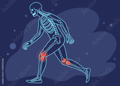 Human skeleton with highlighted knee and shin pain