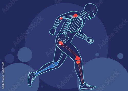 Human skeleton with highlighted joints indicating pain or injury
