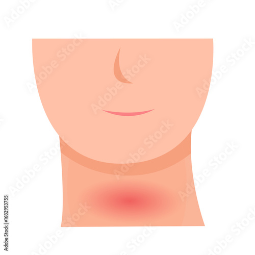 thyroid disease concept. vector illustration