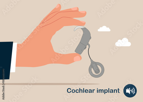Hand holding Cochlear implant. World Deaf Day in last Sunday of September. Cochlear implant device electrically stimulates nerve medical aid ear sound wave adults hard middle exam. Vector illustraton