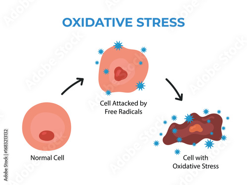 Oxidative Stress Diagram, cell attacked by free radicals, science education