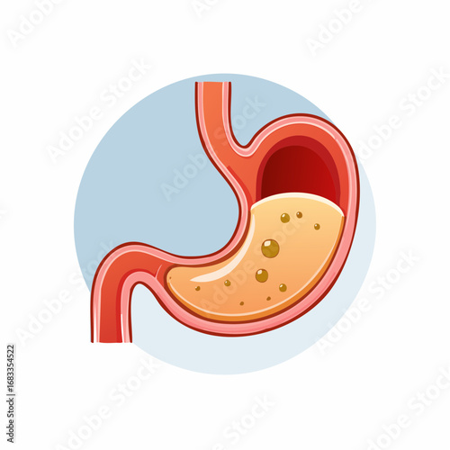 Human stomach anatomy illustration showing partially digested food.