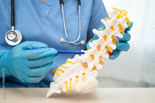 Asian doctor holding spinal nerve and bone model, Lumbar spine displaced herniated disc fragment for treatment medical in the orthopedic department.