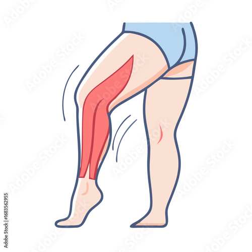 Leg muscle spasm illustration on a black background