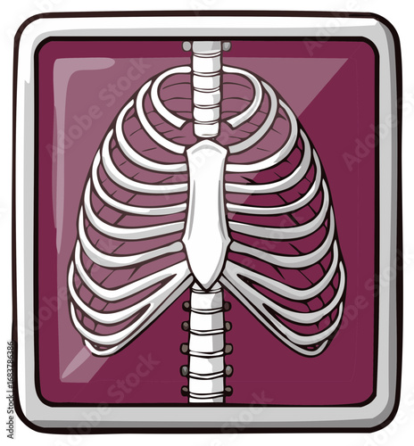 Illustrated chest x ray of a human skeleton showing the rib cage, sternum, and spine