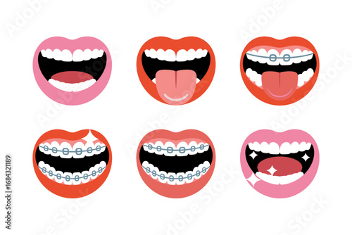 Playful mouth expressions pack, braces smiling teeth, tongue and open laugh, orthodontic variants, dental emoticons, cheeky oral character illustrations