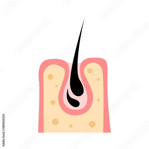 hair loss, alopecia concept. vector illustration
