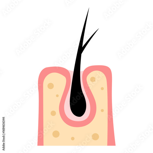 hair loss, alopecia concept. vector illustration