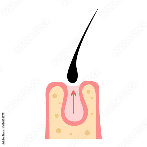 hair loss, alopecia concept. vector illustration