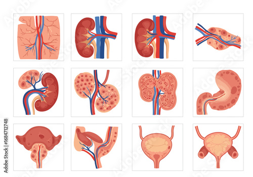 The image displays a grid of anatomical illustrations of kidneys bladders and related human anatomy
