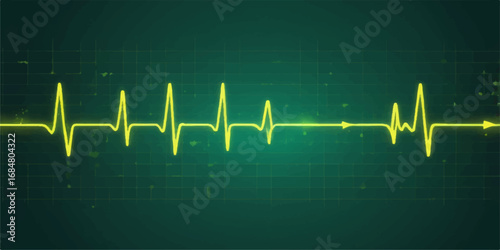 Medical ECG monitor with green heartbeat line graph