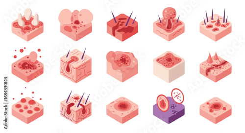 Skin conditions and hair follicle icons in flat design for medical education