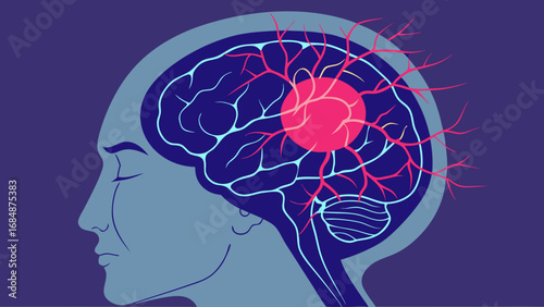 Illustration of a human brain with a red pulsating area and blood vessels