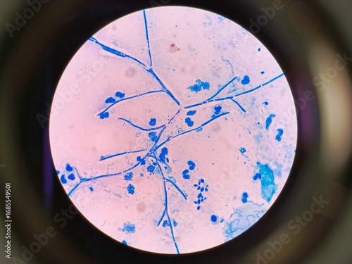 Obraz na płótnie Microscopic view of fungi present in human sputum sample.