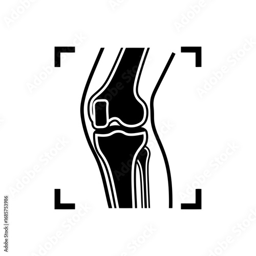 Vector art of black and white illustration of a human knee joint
