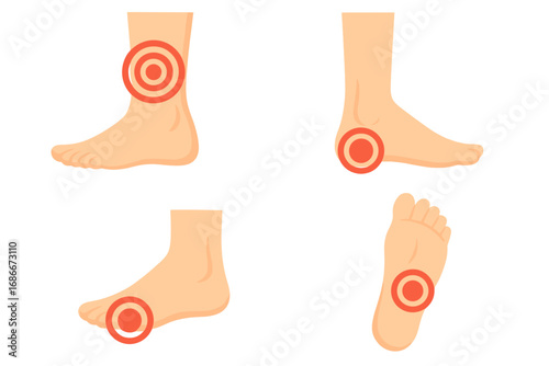 Foot and leg pain points diagram vector set. Medical illustration for education. Anatomy concept showing ache in ankle, heel, and sole. For plantar fasciitis, sprain, or injury.