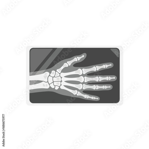X-ray image of a human hand, showing the bones clearly.