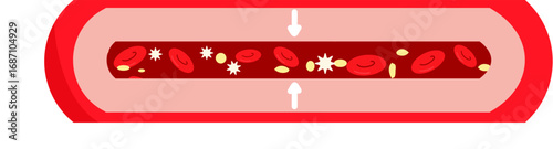Blood vessel constriction 