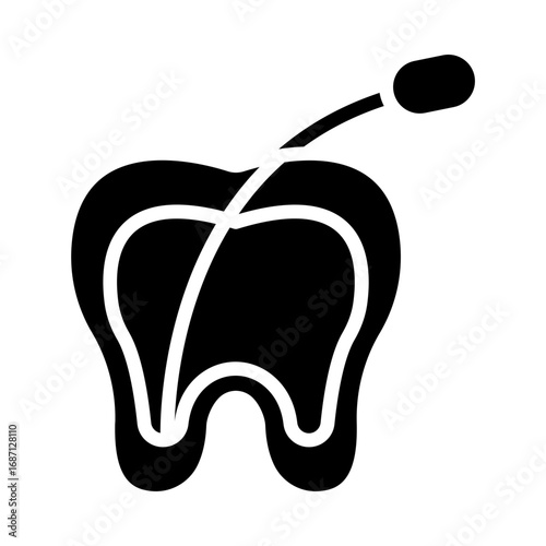Root Canal