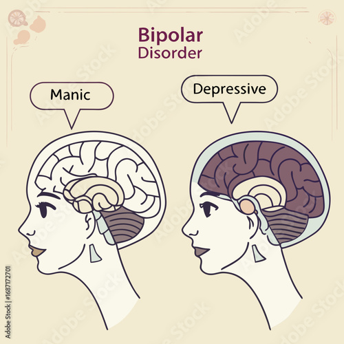 Bipolar Disorder Manic and Depressive Brain States