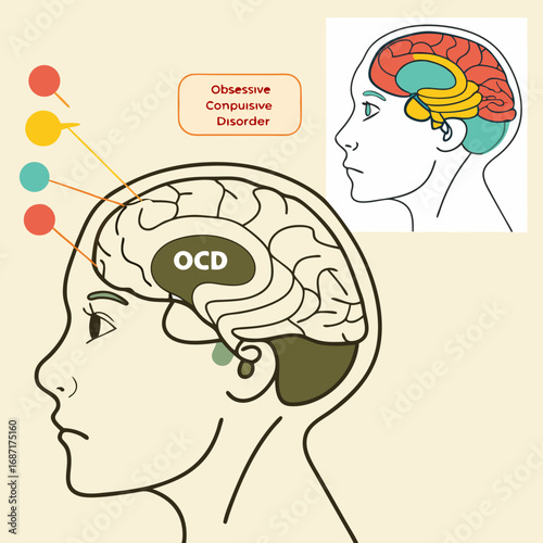 Obsessive Compulsive Disorder Illustration