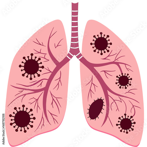 Infected Lungs with Coronavirus Illustration