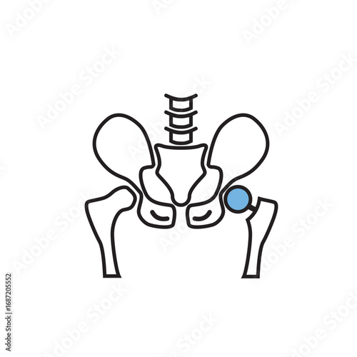 Hip replacement implant icon