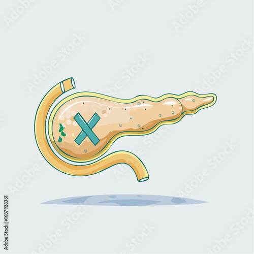 Minimalist Vector Icon of Pancreas with Broken Insulin Symbol