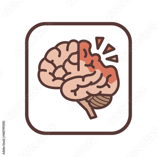 brain stroke affecting cognitive function depicted with damage triangles affecting memory learning cognition