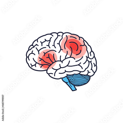 brain damage causing cognitive decline in humans impacting memory and attention perfect for medical education materials
