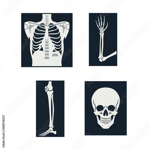 X-ray images of human skeletal system: chest, arm, leg, and skull.