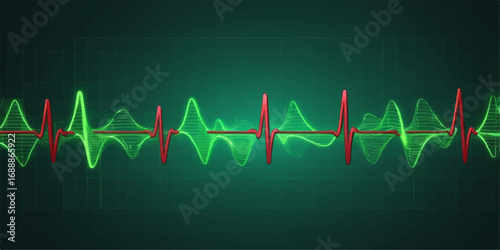 Cardiogram showing a green heart rate pulse on a medical monitor