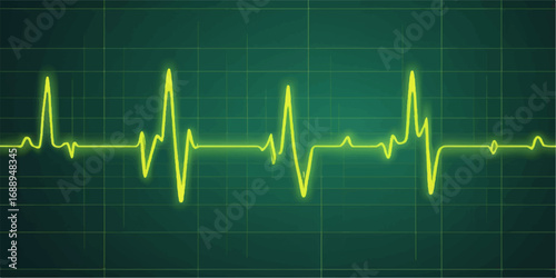Blue cardiogram line illustrating a healthy heartbeat pulse on a green medical monitor