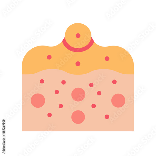 Simple illustration of skin with pimple in flat style