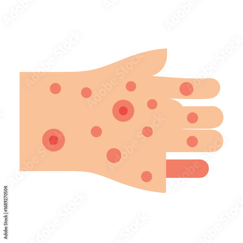Hand Illustration with Red Spots on Skin Rash Black