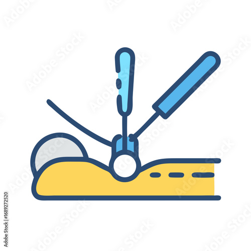 Simplified acupuncture treatment illustration on patient with needles