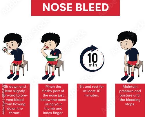 Vector illustration of a nose bleed first aid