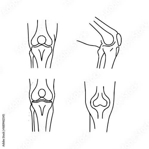 Four illustrations of a human knee joint are displayed. The drawings vary in style: two show anatomically