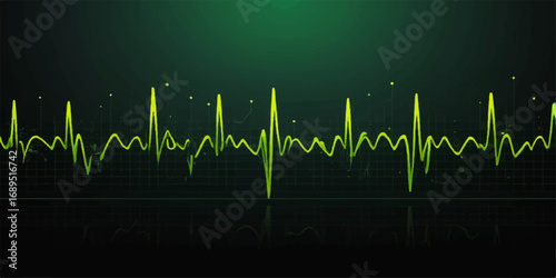 Green medical heartbeat graph on a hospital monitor showing a healthy life pulse
