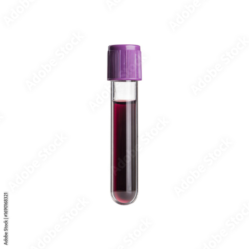 Blood Sample in Test Tube with Purple Cap - Medical Laboratory Science