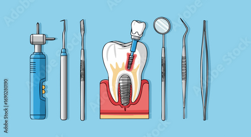 Dental Implant Procedure with Various Dentist Tools