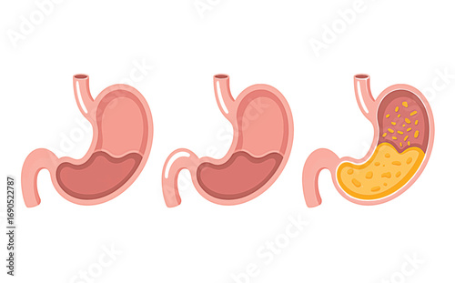 Illustration of a human stomach in three stages of digestion anatomy organ