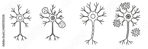 Diagram comparing healthy neurons to diseased neurons with amyloid plaques and demyelination, showing the effects of neurodegenerative conditions