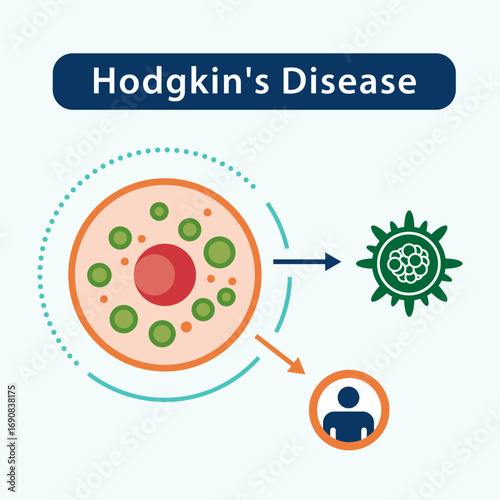 hodgkin's diseaseHodgkins Disease illustration showing cells and person affected