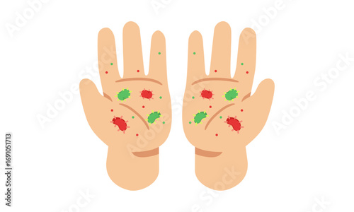 An illustration of two human hands covered with red and green spots representing germs, bacteria, and viruses.