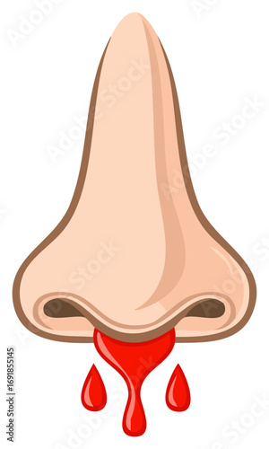 Nosebleed Illustration: Cartoon nose with dripping blood, health concern depiction