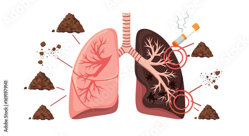 Understanding Smoking's Impact: A Visual Comparison of Healthy Lungs and Lungs Damaged by Tar and Tobacco Residue