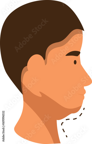 Profile of a male patient undergoing mentoplasty, a surgical procedure to reshape the chin