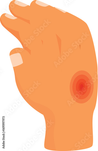 Close up of a hand experiencing skin irritation, possibly indicating eczema or a rash